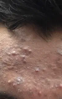 خدمات پوست