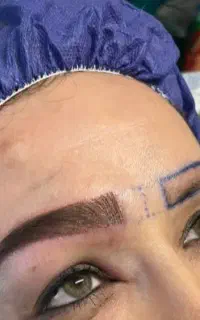 جشنواره کاشت مو و ابرو