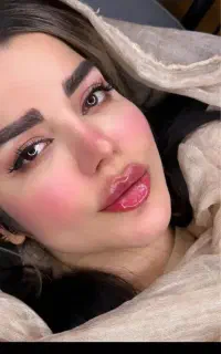 بوتاکس و فیلر قیمت قبل