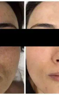 کرم روشن کننده