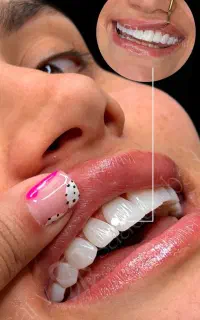 لبخندی زیبا با بیمه طلایی شو50٪