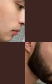 با این محصول تو ۳۰ روز تضمینی ریشات رشد میکنه