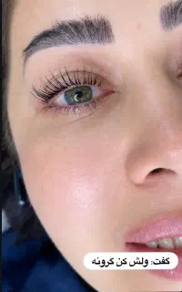 اموزش لیفت با قیمتفوق العاده به روش کره ای وکلاسیک