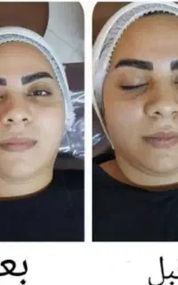 پاکسازی صورت