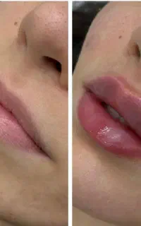 خدمات تخصصی ، ژل ، بوتاکس، لیزر در مطب دکتر شریفی