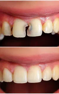 دندانپزشکی اقساطی، با نوبت دهی فوری‌و بدون معطلی