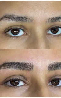 متخصص میکرو کرکی نچرال