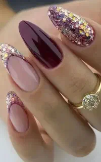 کاشت مژه