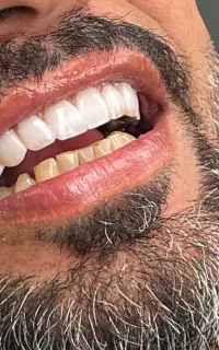 کامپوزیت اقساطی  با طلا ومستمری بگیران رفاه