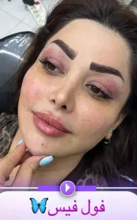 ژل،بوتاکس،پی ارپی،مزوژل،مزونیدلینگ50درصدتخفیف