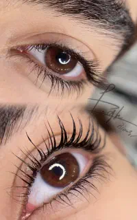 برای زیبایی (دائمی)خودت هزینه کن