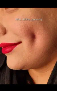 اجرای تاتو پرسینگ میکرودرمال چال لپ