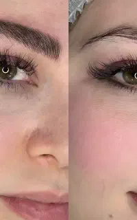 تخفیف۴۰درصدی میکروبلیدینگ،شیدینگ،بنمژه،لیفت ولمینت