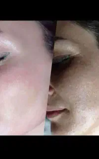 زیبایی و‌اعتماد به نفس حق شماست با کرم درخشان