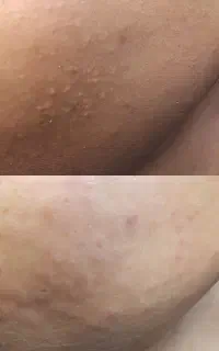 خدمات فیشال تخصصی و پاکسازی پوست و مشاوره تخصصی