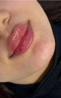 پوست مو زیبایی