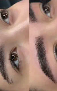 آموزش صفر تاصداجرای فیبروز /شیدلب/ بن مژه با تخفیف