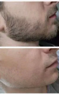 ریشتو پرپشت بکن خجالت بکش
