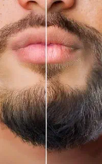 رویش ریش یا مو باما مصرف نسخه باشما