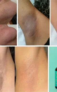 رفع دائم موهای بدون لیزر (پرداخت درب منزل)