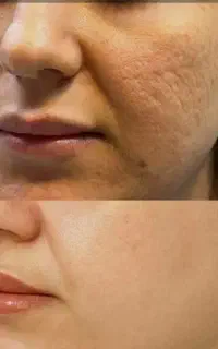 آراف فرکشنال منافذباز و جای اسکار