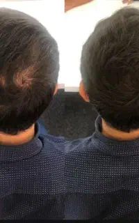 وقت تغییر رسیده با سرم تقویت مو
