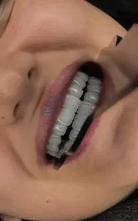 جشنواره ویژه ی دندانپزشکی خرداد ماه