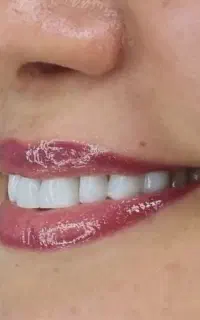 اعطای نمایندگی رسمی طلایی شو...کل ایران