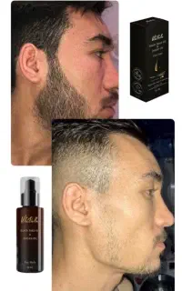 پشمالو شو