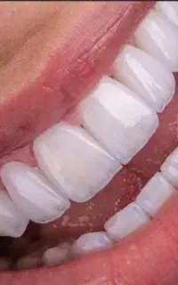 کامپوزیت و لمینت پردیس