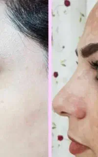کرم سفید کننده قویی