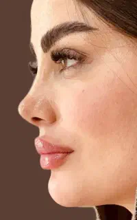 عمل بینی بلفارو پلاستی ساکشن غبغب ابدو ساکشن