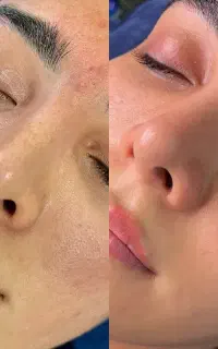 پاکسازی