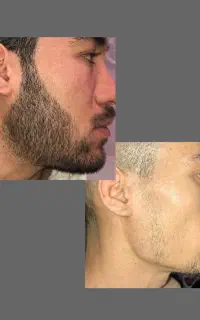 تولد دوباره ریش و سبیل