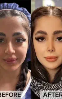 جشنواره عمل رینوپلاستی و ترمیمی