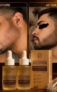 تقویت مو . ابرو. با طب نانو