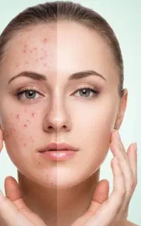 جوش خشک کن ۶۰ ثانیه‌ای