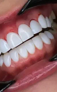 خدمات دندانی نیمه رایگان با اقساط و ضمانت