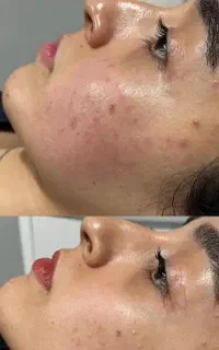 پاکسازی و فیشیال تخصصی