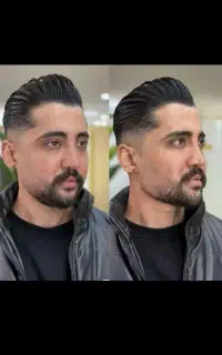 زببایی ژل بوتاکس