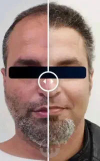 تیم کاشت حرفه ای از تهران برای اولین بار در مهاباد