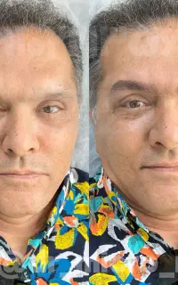 میکروبلیدینگ ابرو استایل آقایان