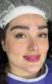 کاشت ابروی دائمی هایپر نچرال و لیفت در الهیه