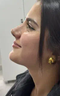 جشنواره عمل بینی