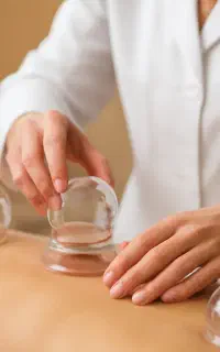 حجامت، زالو درمانی، فصد خون(حرفه ای و قیمت مناسب)