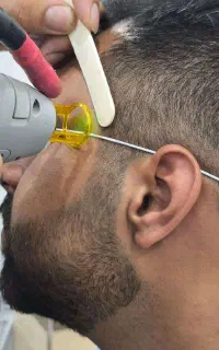 جشنواره معرفی لیزر موی زائد باکندلا اصل آمریکا