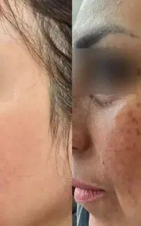 بیوممتیک اورجینال (محو کننده لک، کک ومک)