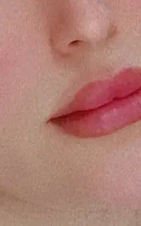 ژل وبوتاکس