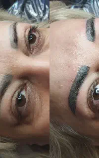 میکروبلیدینگ و میکروپیگمنتیشن ابرو