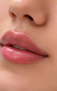 آموزش و خدمات ژل ،بوتاکس، مزوژل